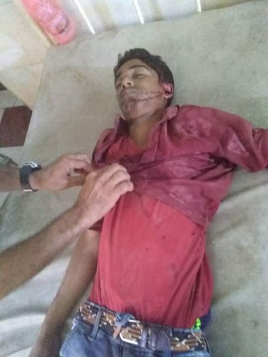  : وفاة جندي وإصابة آخرين بحادث مروري مروع في الملاح. 