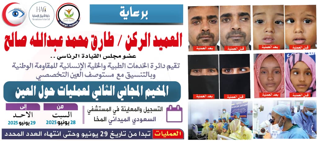 برعاية طارق صالح.. الإعلان عن المخيم المجاني الثاني لجراحة حول العين في المخاء