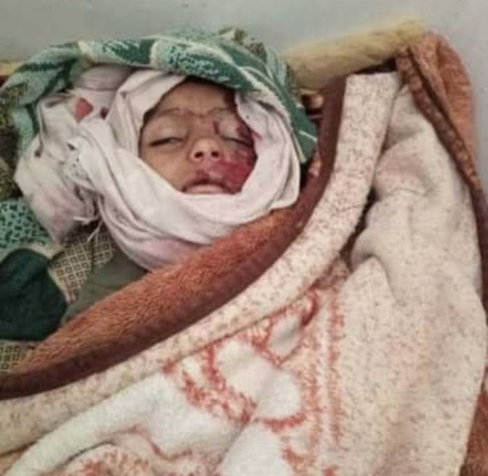 طفل في تعز يدفع حياته ثمنًا للحصول على شربة ماء