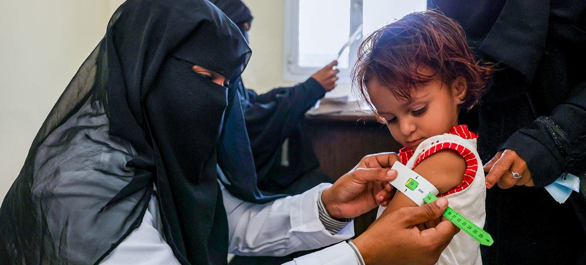 أطباء بلا حدود: آلاف الأطفال في اليمن يواجهون سوء تغذية حاد مع تراجع الدعم الإنساني